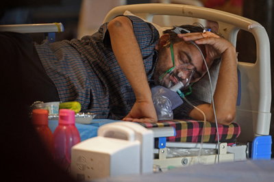 コロナ患者の真菌感染増加 インド医師らが警鐘