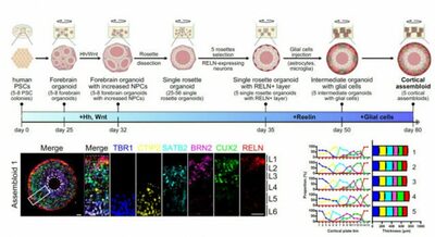 人間の脳を完全に再現したミニ「脳アセンブロイド」…ソウル大学などのチームが開発