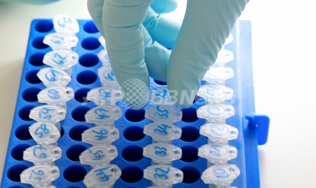 大腸菌流行、ドイツ当局が終息宣言 大腸菌流行、ドイツ当局が終息宣言