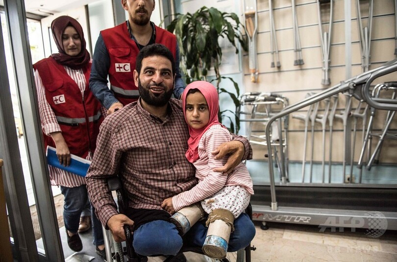 父の手作り、空き缶義足のシリアの少女 写真が反響 トルコで治療へ