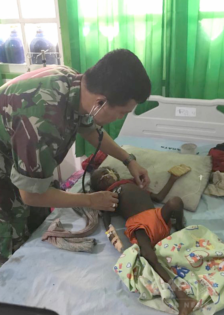 子ども800人が麻疹や栄養失調、100人死亡か インドネシア・パプア州