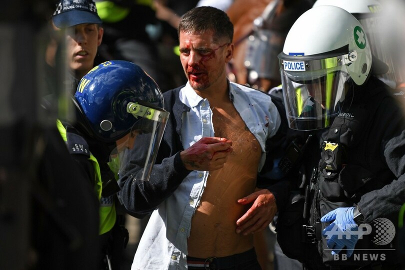 英極右活動家ら、人種差別抗議に対抗し警察と衝突 100人超逮捕
