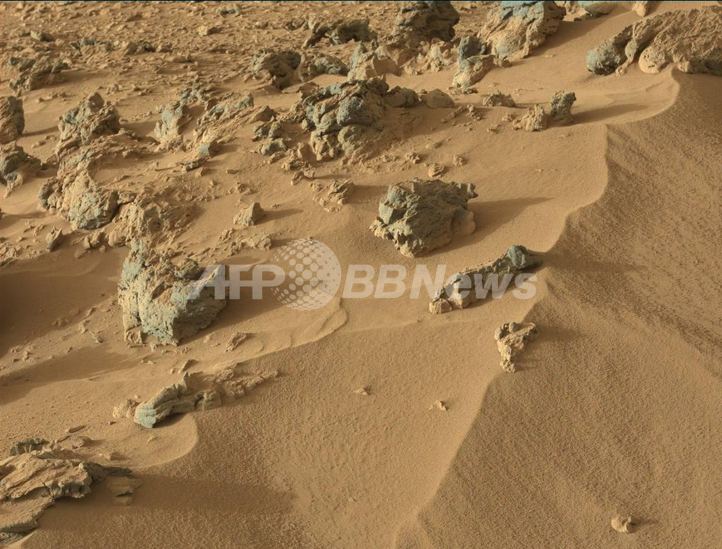 長期宇宙ミッションでアルツハイマー病が加速する恐れ、米研究 長期宇宙ミッションでアルツハイマー病が加速する恐れ、米研究