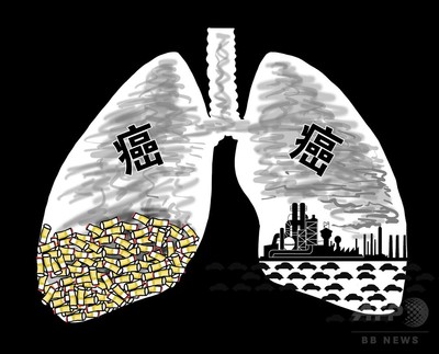 中国自主開発の末期肺がん治療薬承認 国家食品薬品監督管理局 写真1枚 国際ニュース Afpbb News