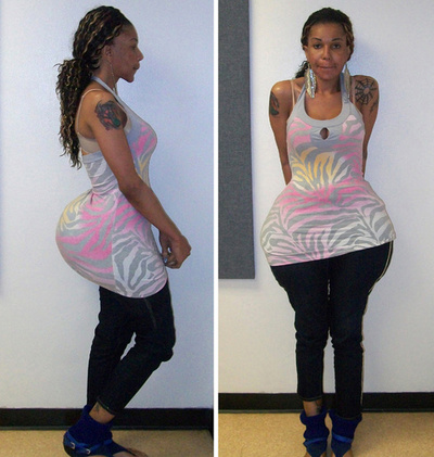 無免許で美容整形の偽医師に禁錮1年、米フロリダ