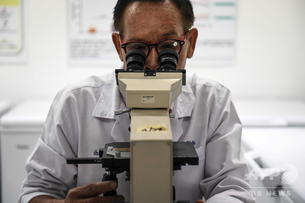 児童虐待、被害者に残る「分子の傷跡」 研究 児童虐待、被害者に残る「分子の傷跡」 研究