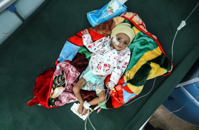 イエメン大飢饉の恐れ 国連、フーシ派のテロ組織指定撤回を米に要請