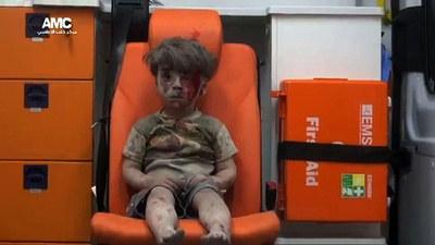 空爆後に救出されたシリア少年の画像、民間人犠牲の象徴に