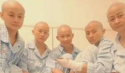 やけどした姉弟の皮膚移植のために親族5人が頭皮提供 中国