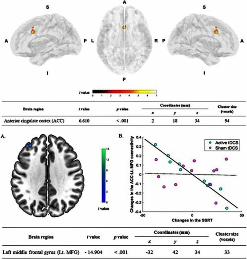 脳領域機能的MRIによって視覚化された治療前後の脳(c)KOREA WAVE
