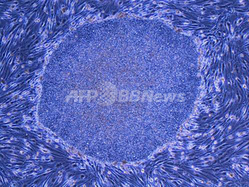 ヒトiPS細胞作製の京大教授「ES細胞の研究も必要」