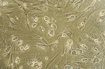 iPS細胞の安全な作製手法を開発、来年に臨床試験へ