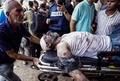 イスラエル軍の爆撃後、パレスチナ自治区ガザ地区中部デイルアルバラのアクサ殉教者病院に運び込まれる負傷者（2024年6月8日撮影）。(c) Bashar TALEB / AFP