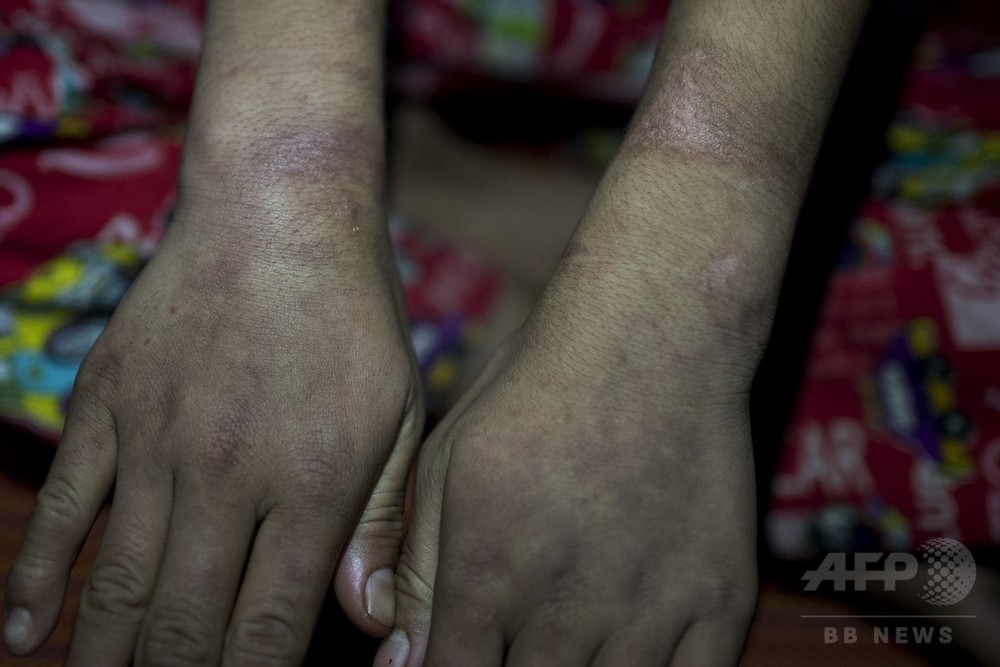 No32-03/05ミャンマーで手に入れたコランダム，ルビー12pcsルースでデザインされたビブネックレス MITTAN KNA-03 手甲 | Routes*Roots powered by BASE