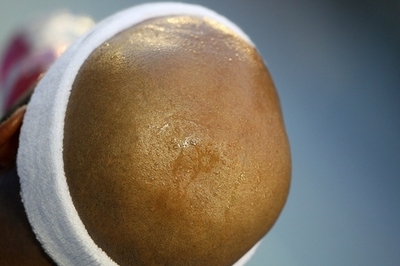 「はげ」は名誉毀損に当たらず、韓国最高裁