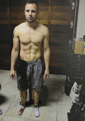 血まみれのピストリウス被告、南ア警察が写真公開