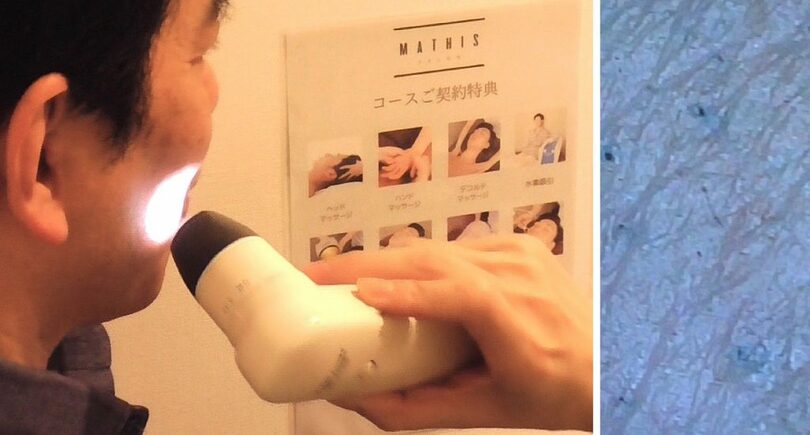 （左）米村さんの右頬にマイクロスコープを当てられる（右）モニター画面に映し出された皮膚の表面(c)KOREA WAVE