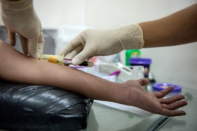 血中のHIV抗原、感染から1週間以内に検出可能に スペイン研究