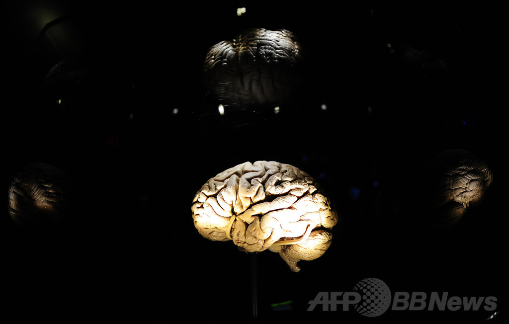 脳への電気刺激で明晰夢に誘導する実験に成功、独研究 脳への電気刺激で明晰夢に誘導する実験に成功、独研究