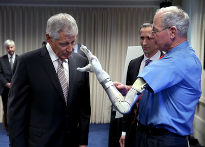 料理もできるハイテク義手、米で販売へ