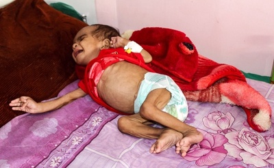 紛争で年間10万人超の幼児が死亡、国際NGO報告