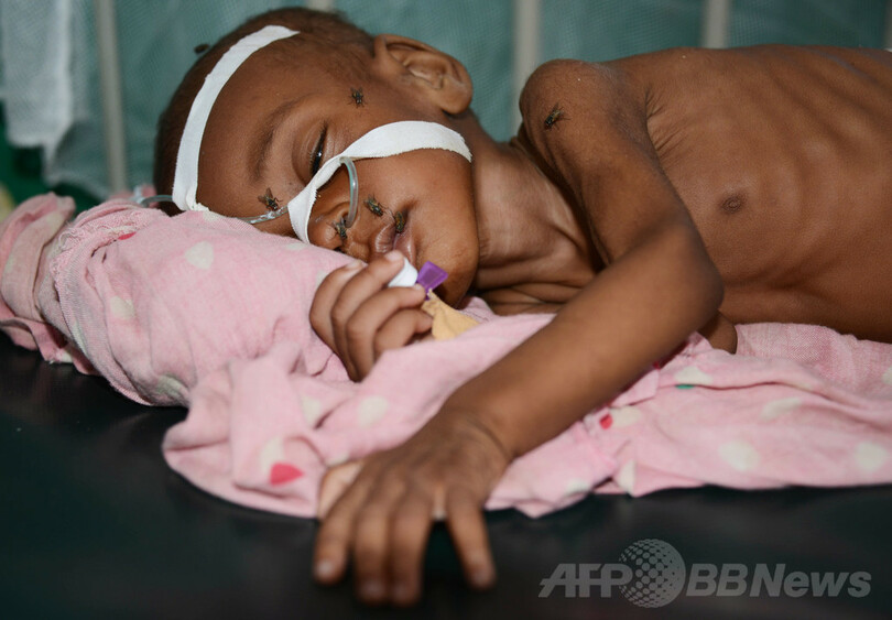 ソマリアの子ども万人に餓死の恐れ ユニセフが警鐘 写真1枚 国際ニュース Afpbb News