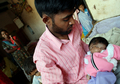 インドで顔が2つある赤ちゃん誕生 神の化身 写真4枚 国際ニュース Afpbb News