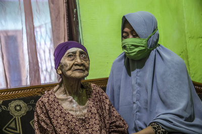 100歳女性がコロナ感染から回復、インドネシア最高齢