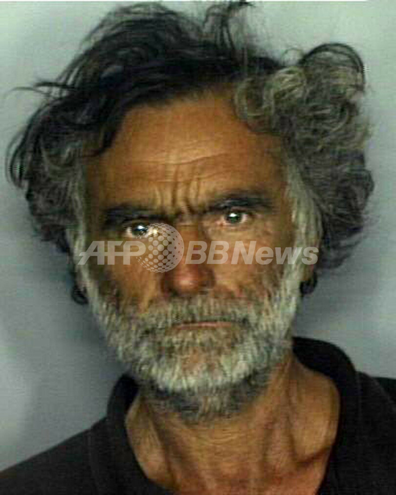 米マイアミで顔を食いちぎられた男性 順調に回復も失明の恐れ 写真1枚 国際ニュース Afpbb News