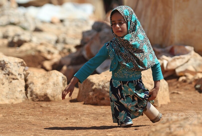 父の手作り、空き缶義足のシリアの少女 写真が反響 トルコで治療へ