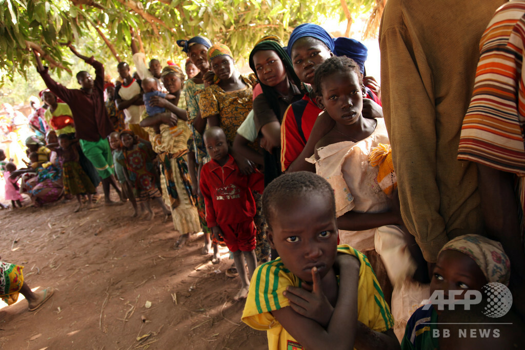 【写真特集】世界各地で報告されている「難病・奇病」