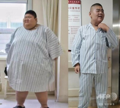 1年で0キロの減量に成功 山東省の歳男性 写真1枚 国際ニュース Afpbb News