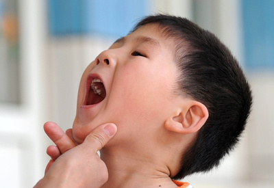 子どもを襲う珍しいウイルス性呼吸器疾患、米12州で確認