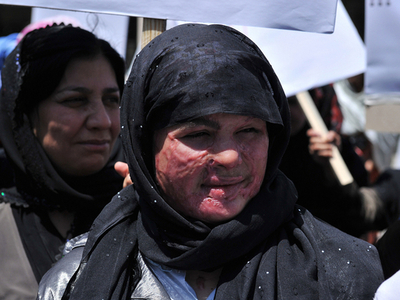 不倫で公開処刑、アフガニスタン女性ら怒りの行進