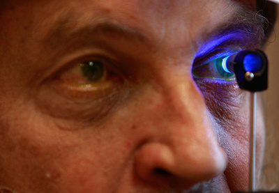 抗HIV薬、加齢黄斑変性にも効果か 米研究