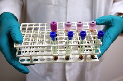 アジアで増加するウイルス性肝炎で30秒に1人死亡、NGOが警鐘