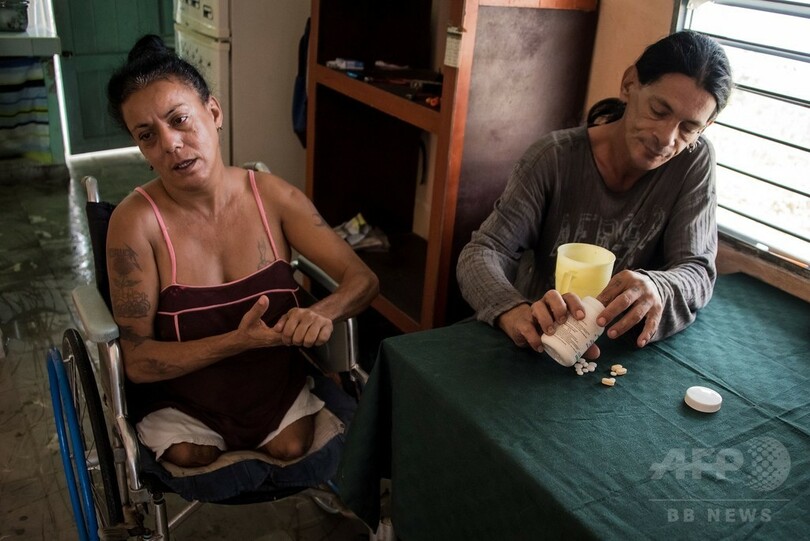 自らHIV感染したキューバのパンクス「フリキス」の現在