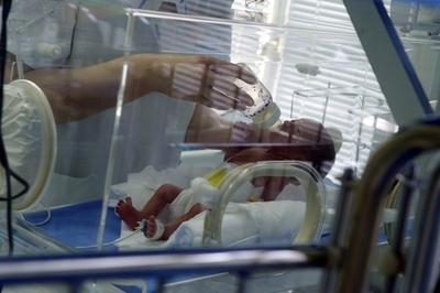 21週5日で誕生の超未熟児が無事退院、最短妊娠期間記録に並ぶ ドイツ