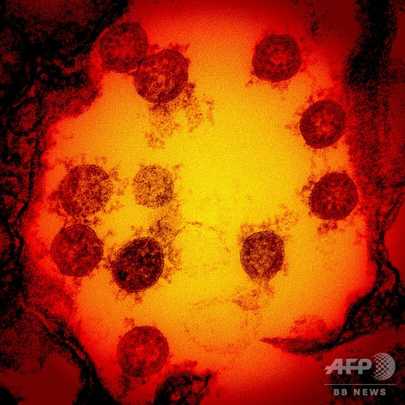 イーライリリー、コロナ治療薬の治験中断 安全性に懸念