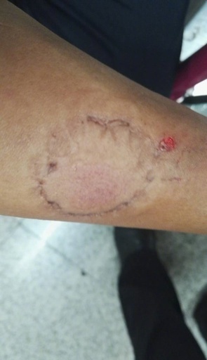 痴漢が警官をかんだ！北京