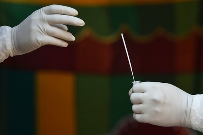 スロバキア、全国民にコロナ抗原検査 全国規模では世界初