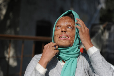 女性への酸攻撃多発のインド、酸の売買規制へ