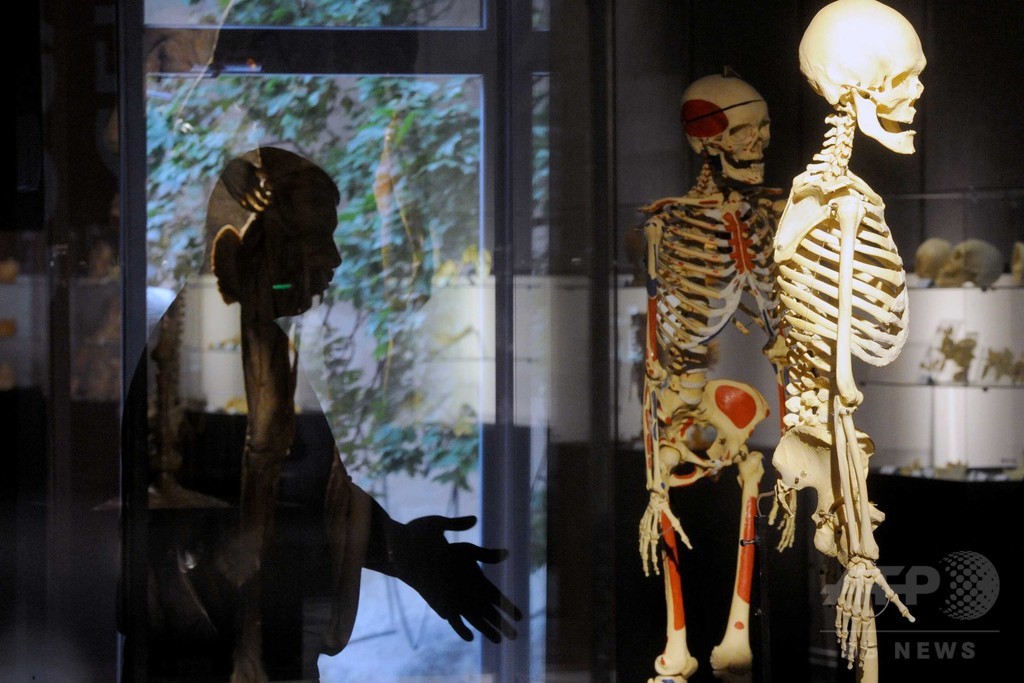 3Dプリントの人工骨、周囲の骨再生を促進 米研究 写真1枚 国際ニュース:AFPBB News