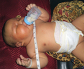 ミルクを飲むインドネシア・北スマトラ（North Sumatra）州で生まれた体重8.7キロの赤ちゃん（2009年9月23日撮影、アブドゥル・マナン病院提供）。(c)AFP/ABDUL MANAN DISTRICT GENERAL HOSPITAL