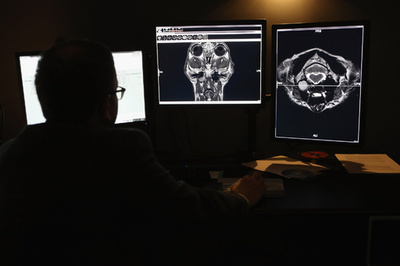 HIVの「隠れ家」をスキャン技術で特定、米研究