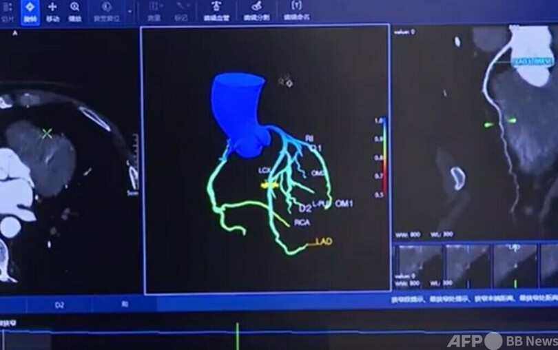 北京の病院 インテリジェント診断補助システムを導入
