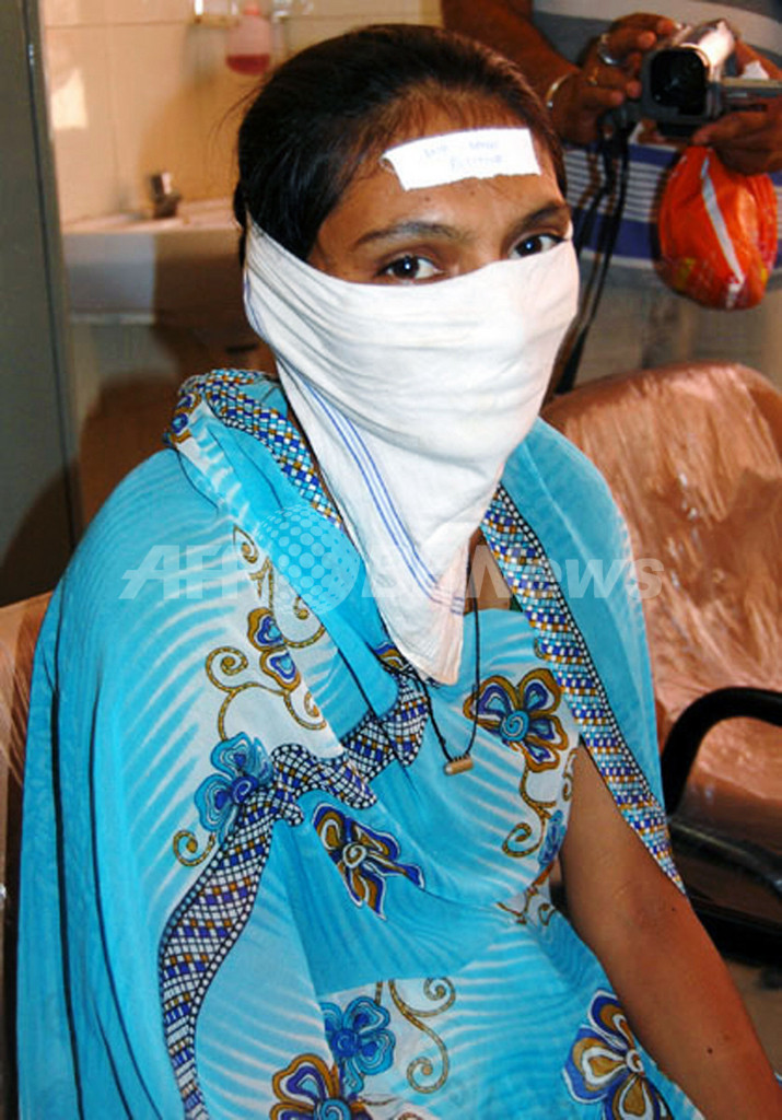 インドでHIV陽性の女性の額にステッカー、医師が謝罪