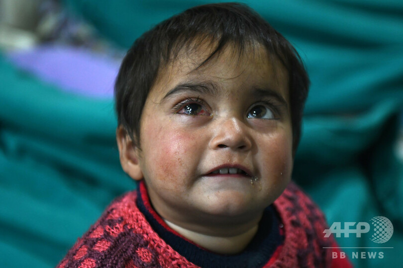 1歳の子の目に金属片… 衝突続くカシミール、物議醸す散弾銃