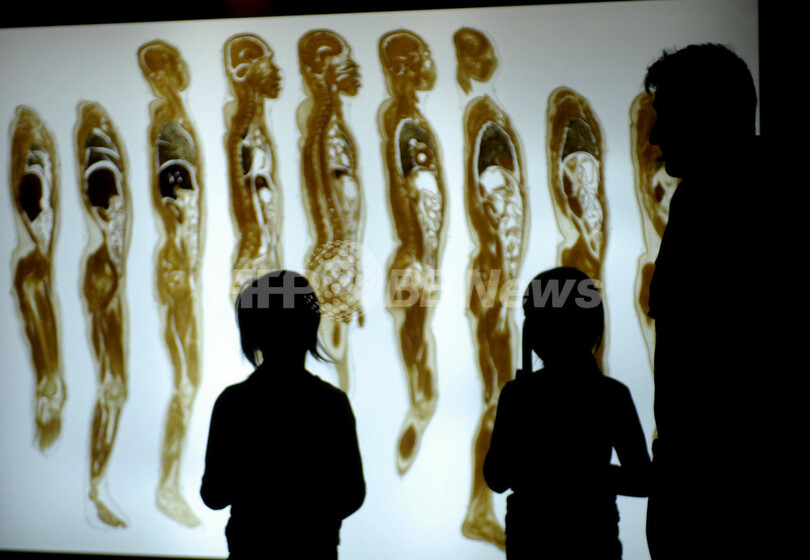 「本物の標本」で人体の不思議を探訪 - チェコ